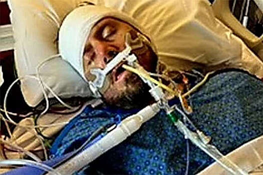 Daily Mail: в США мужчина обжег палец руки во время готовки и лишился ног