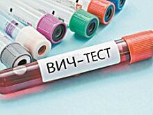 За заражение ВИЧ перестанут наказывать?