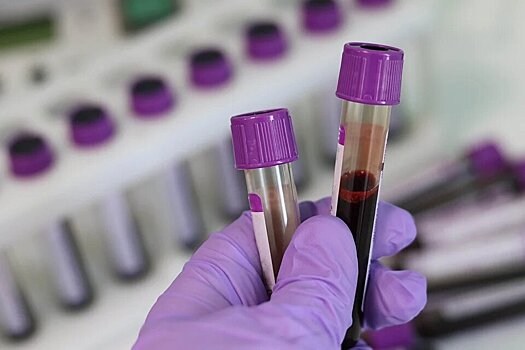 В Пензенской области выявили еще 398 случаев коронавируса