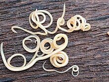 Паразитолог предупредил, что глисты могут жить в любой части тела