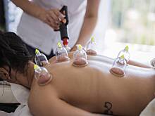 Что такое хиджама и может ли эта процедура принести пользу здоровью