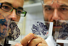 Ученые призвали людей жертвовать мозг науке