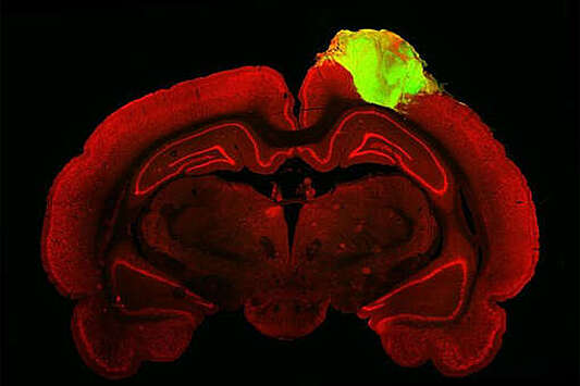 Повреждения в мозге крысы исправили с помощью человеческих нейронов