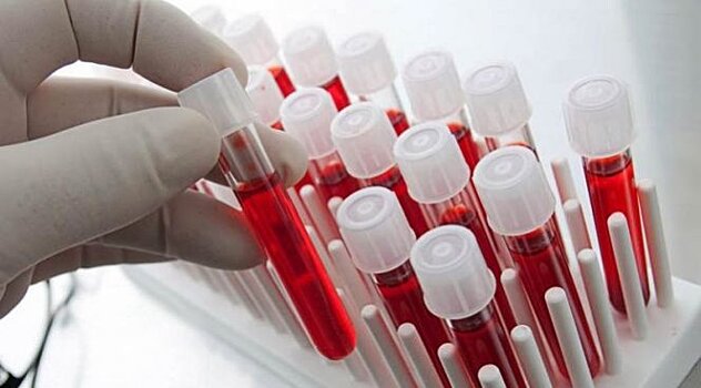 Врачи указали на самую опасную группу крови