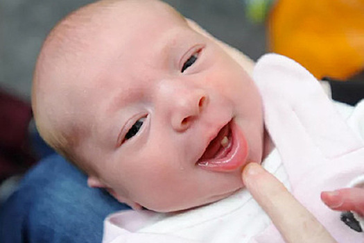 Ребенок родился с полноценным зубом и удивил врачей