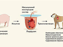 Бабуин с сердцем свиньи: ученые сделали уникальную операцию