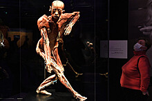 Выставка Body Worlds повысила возрастной ценз до "18+"