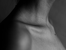 Онколог рассказал, как снизить риск развития рака кожи