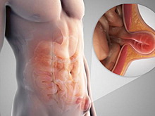 В ТЦСО «Зеленоградский» расскажут о грыжах брюшной полости