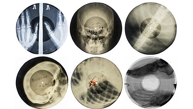 Как в СССР распространяли запрещённую музыку на рентгеновских снимках