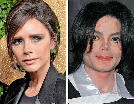 Звезды с самой дорогой пластикой