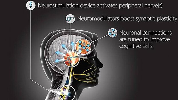 DARPA разрабатывает технологию «взлома» мозга солдат для наделения их сверхспособностями