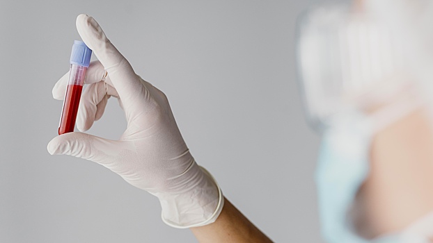 Врач-гематолог развеяла миф о «главном анализе на тромбы»