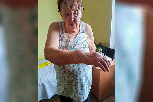 В Красноярске дочь рассказала об избиении матери-ветерана в пансионате
