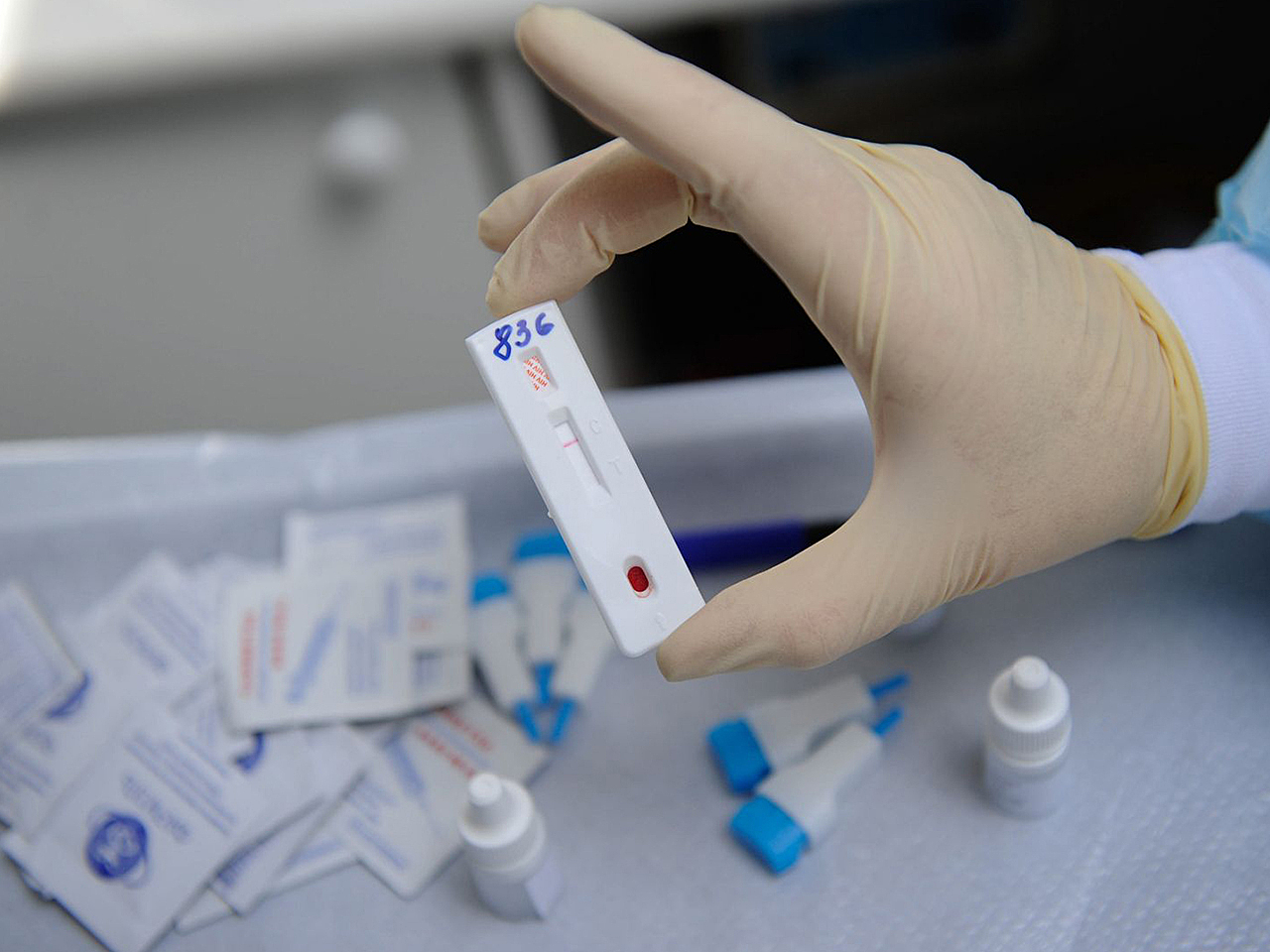 В Оренбургской области более 470 тыс. человек пройдут тест на ВИЧ
