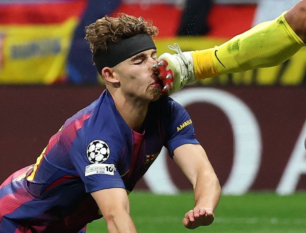 Вратарь «Атлетико Мадрид» ударил по лицу футболиста «Барселоны» в матче Лиги чемпионов