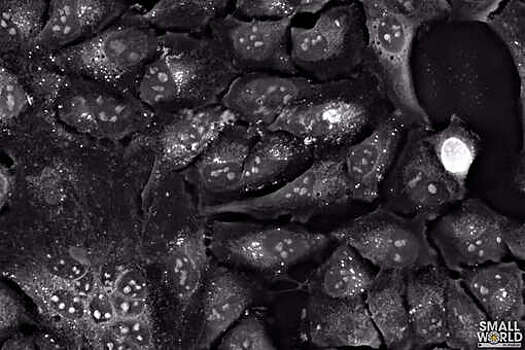 Видео с гибелью клеток больного COVID-19 человека победило в Nikon Small World