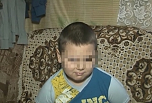 Бастрыкин поручил разобраться, почему мальчика без глаза в Ростове не признают инвалидом