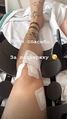 Ещенко показал прооперированную ногу и поблагодарил болельщиков за поддержку