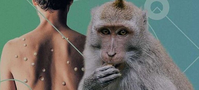 Бразилия объявила максимальный уровень санитарной угрозы из-за оспы обезьян