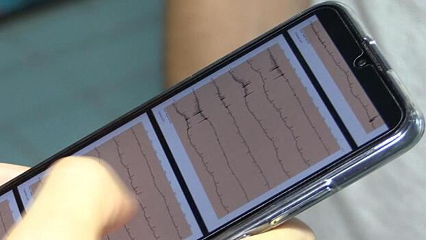 Миниатюрный кардиограф для смартфона изобрели в Дубне