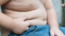 Эксперты предложили создать новую программу профилактики ожирения