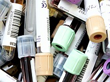 Врач объяснил, почему может позеленеть кровь