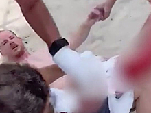 Акула набросилась на отдыхающего и отгрызла ему кусок ноги