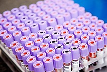 В Пензе за сутки выявили 289 случаев коронавируса