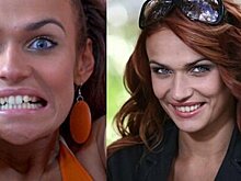 Скажите «сыр»: как преобразились российские и зарубежные звезды после того, как «сделали» красивые зубы