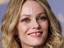 7 голливудских звезд, которым не мешало бы заняться зубами