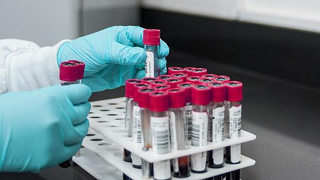 109 человек заразились коронавирусом за минувшие сутки на Вологодчине