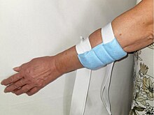 Инновационное устройство для остановки крови создали в Нижнем Новгороде