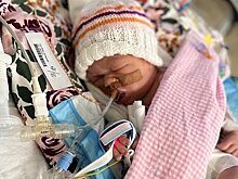 Девочка родилась с внутренними органами вне брюшной полости