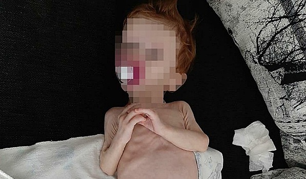 «Девочка из шкафа» жива, несмотря ни на что