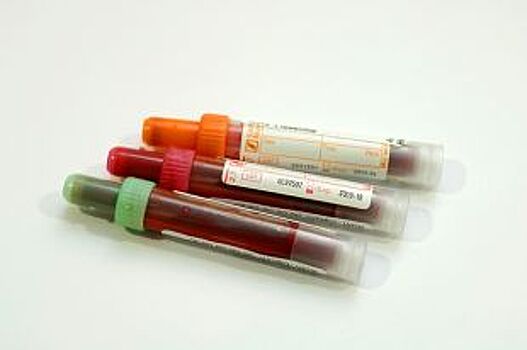 Челябинцы с тромбозом бесплатно проверят уровень свёртываемости крови