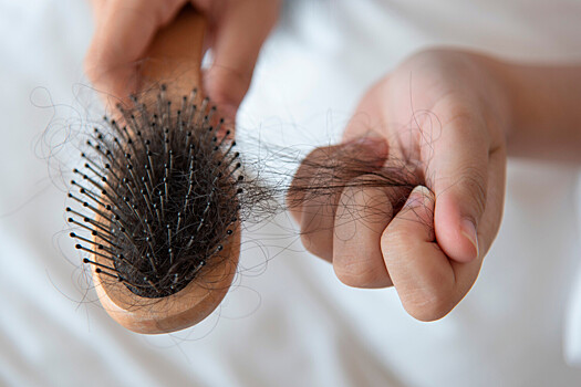 Развеяно заблуждение о стрессовом выпадении волос