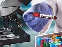 Оперативные данные по Covid-19 в Калужской области на 4 июля