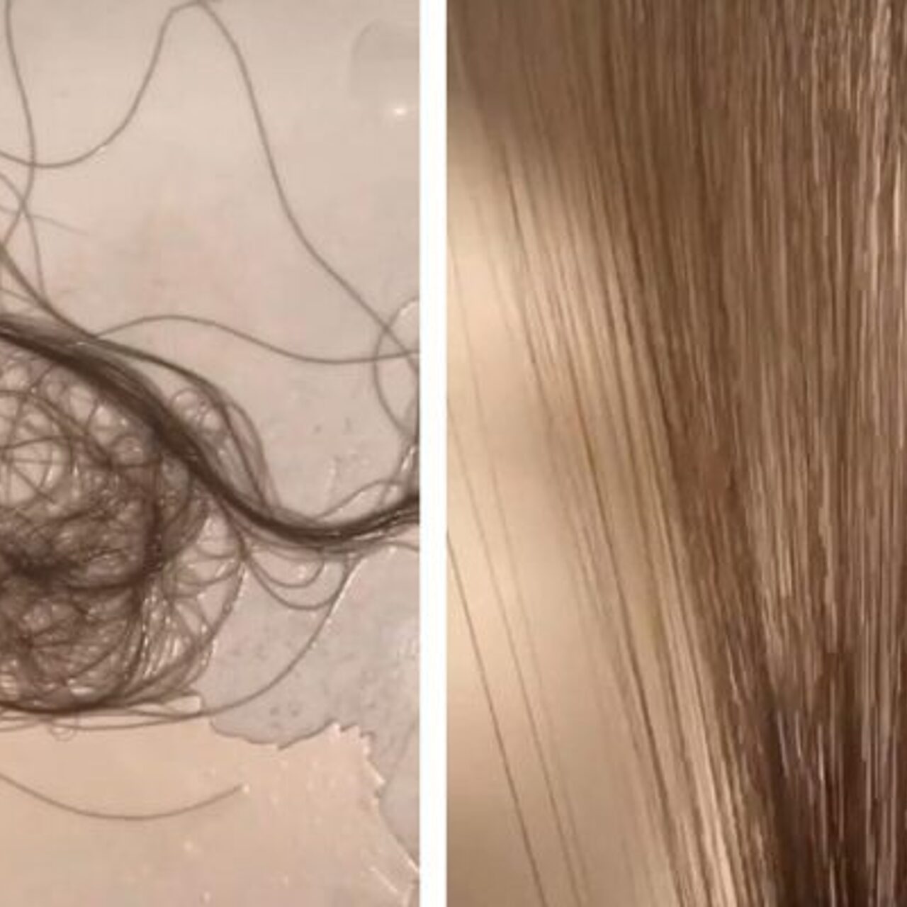 Сколько при мытье выпадает волос норма. Сколько при мытье выпадает волос норма. Норма выпадения волос. Норма выпадения волос в день. Сколько при мытье выпадает волос норма.