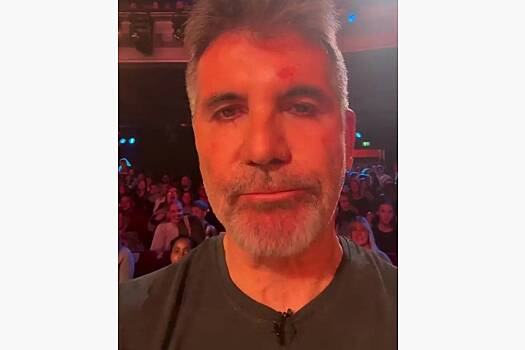 Пропавший из эфира известный телеведущий вышел на связь и показал травмированное лицо