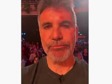 Пропавший из эфира известный телеведущий вышел на связь и показал травмированное лицо