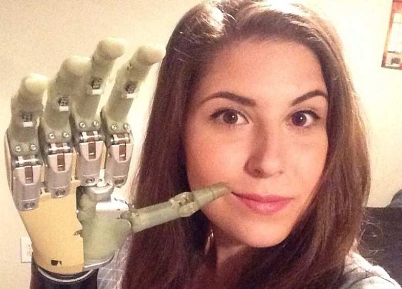 Анжел сама себя в шутку называет киборгом и часто спрашивает, можно ли считать себя на четверть роботом, если вместо одной руки — бионический протез?