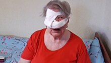 Собака бойцовской породы покусала лицо пенсионерки в Петрозаводске