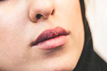 Дерматокосметолог назвал причину постоянной сухости губ