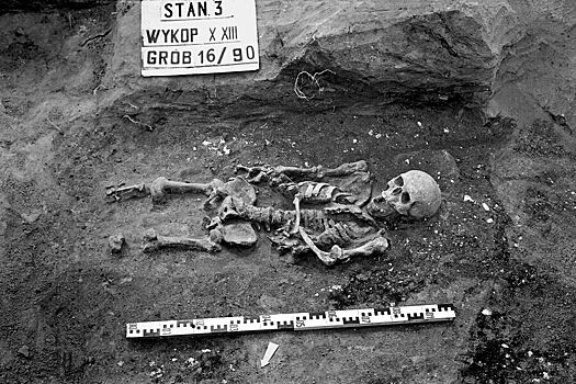 У средневекового скелета из Польши обнаружили сразу две формы карликовости