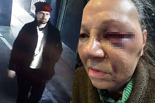 В Краснодаре неизвестный жестоко избил пенсионерку-консьержа