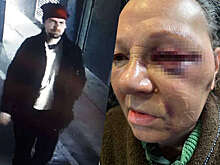 В Краснодаре неизвестный жестоко избил пенсионерку-консьержа