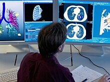 Немецкие эксперты проанализировали преимущества методов лечения эмфиземы легких