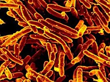 Стало известно, почему палочка Коха так долго живёт и заражает человека