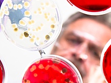 Роспотребнадзор объяснил, чем грозит инфекция из-за  холерообразного вибриона